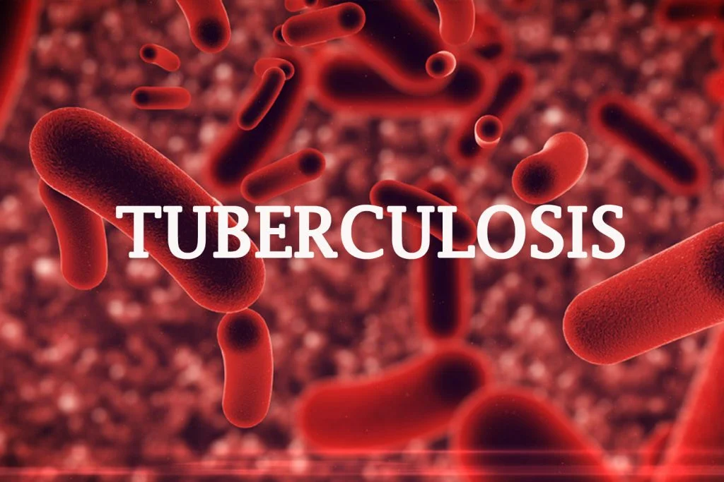 Tuberculosis-1-1024x683